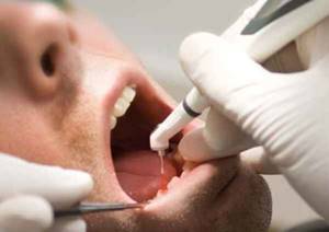 Application in orthodontics