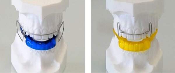 выравнивание зубов с помощью аппарата брюкля